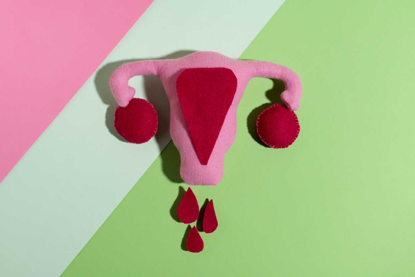 Read more about the article What is Vaginal Discharge Syndrome (Vulvovaginitis)?