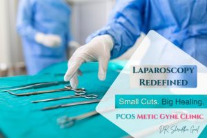 Read more about the article Laparoscopic Surgeries by Expert Female Surgeon in Jaipur: Benefits & Recovery