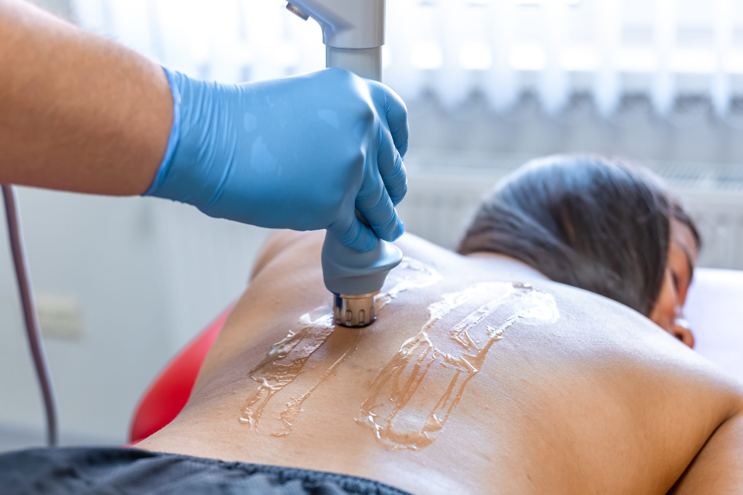 Back & Chest Laser Hair Removal