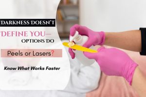 Read more about the article Intimate Area Pigmentation: Chemical Peels vs. Lasers (Which Is Faster?)