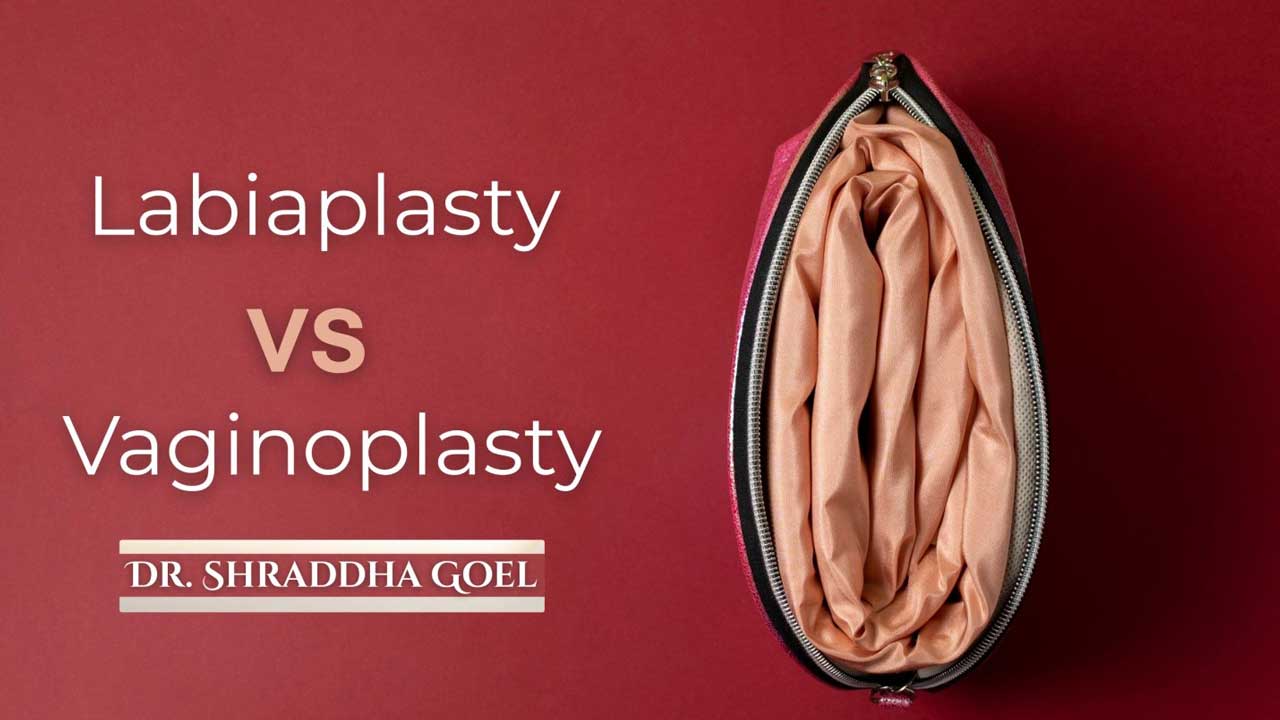 You are currently viewing Labiaplasty vs. Vaginoplasty: Which Surgery Do I Actually Need?